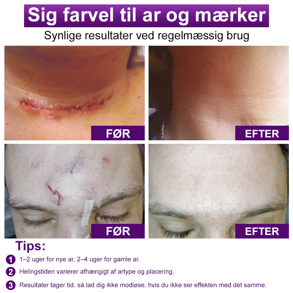 ✅flysmus® cure FACE & BODY SCAR GEL