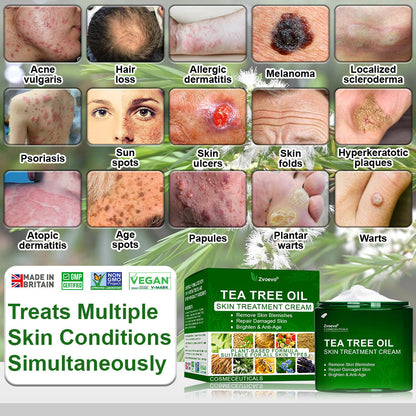 🌿𝐌𝐇𝐑𝐀-𝐀𝐏𝐏𝐑𝐎𝐕𝐄𝐃 ✅𝐳𝐯𝐨𝐞𝐯𝐨® 𝐓𝐞𝐚 𝐓𝐫𝐞𝐞 𝐎𝐢𝐥 𝐒𝐤𝐢𝐧 𝐓𝐫𝐞𝐚𝐭𝐦𝐞𝐧𝐭 𝐂𝐫𝐞𝐚𝐦 – Removes Skin Blemishes, Repairs Damaged Skin, Brightens & Anti-Ageing Care