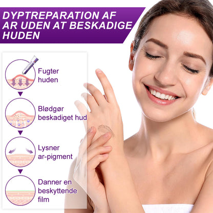 ✅flysmus® cure FACE & BODY SCAR GEL
