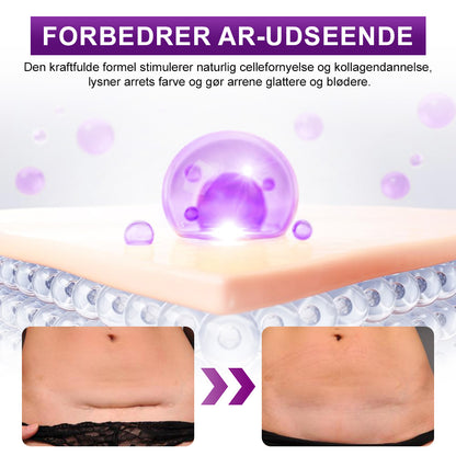 ✅flysmus® cure FACE & BODY SCAR GEL