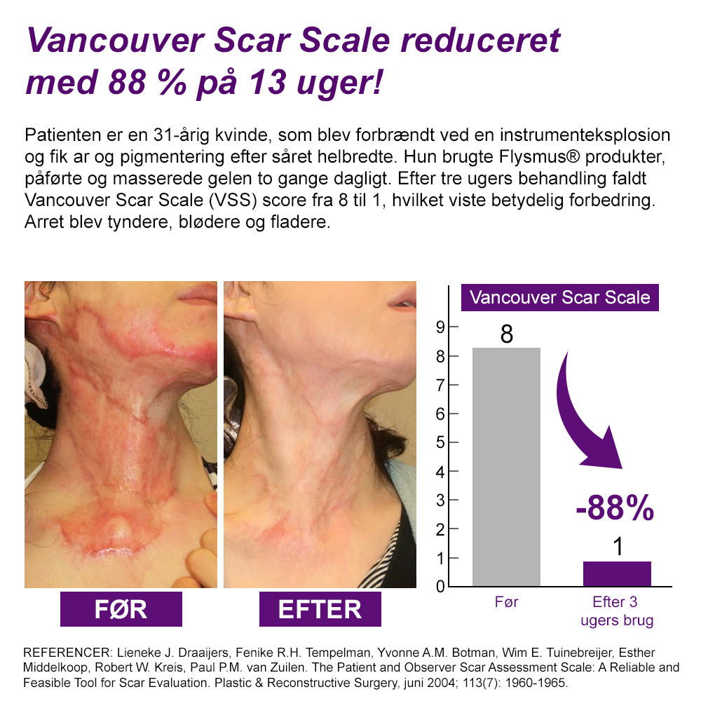 ✅flysmus® cure FACE & BODY SCAR GEL